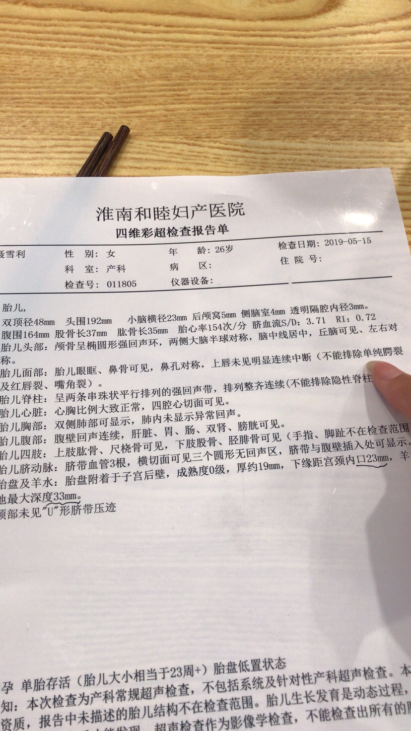四维一次过 宝宝很给力！ 有经验的看看男宝还是女宝哈😂😂😂 看看像谁😂😂