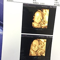 鼻子大耳朵大猪八戒🐷