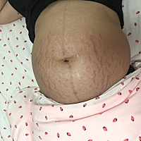 生产前后对比图