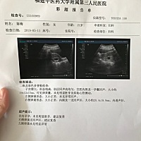 3.25的末次月经  5.11去检查的只有卵黄囊  未见胎心胎芽  哎 你们有这样的吗?  好紧张  这周再去复查一...