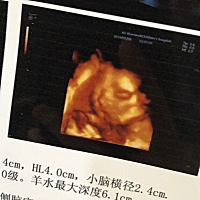 “小可乐”的第一次四维彩超❤️ 也终于知道你是个小猪弟了😘😘 爸爸妈妈特别期待你的到来呦~~ 觉得...