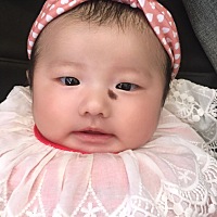 宝宝胎记成功切除了。第十天。