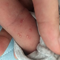 宝宝还没满月，知道是长的什么吗？有什么办法可以弄好呢？