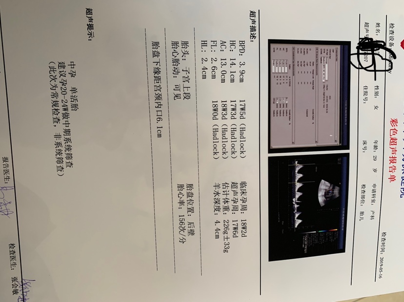 能不能看出是男孩还是女孩呀！