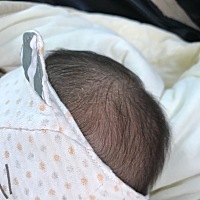 亲们，宝宝头顶有一块长的这个，就像那种没洗干净的污垢，基本上是三天洗一次头，应该不会是吧？我都是...