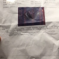 求好心人帮我看一下孕检正常吗？医生说不排除宫外孕的可能，我好担心