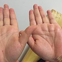 怀孕最后一周突然发现双手掌心下同样位置出现一颗红色点，有没有同样症状？