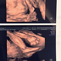 四维顺利通过，宝宝脚好大，猜猜男女