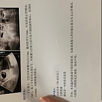 亲们有经验的帮我看下，这正常吗？害怕流产