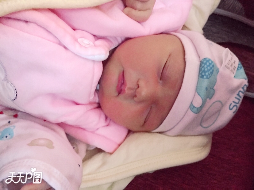 为什么四维的图片和生下来的孩子长相不一样？有宝妈有这种情况吗？