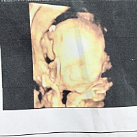 为什么四维的图片和生下来的孩子长相不一样？有宝妈有这种情况吗？