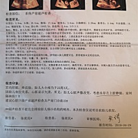 室间隔缺损 左侧脑室增宽，有同样情况的宝妈吗？