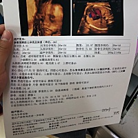 四维刚做完，看到孩子的脸很激动，也很好奇男孩女孩，有人能看出来么？