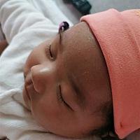 宝宝额头上反反复复长这些疹子，妇幼开的湿疹药擦了没什么作用，有经验的宝妈帮看下怎么消除？🙏🙏