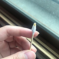 宝宝四个月了，耳朵里是这样的，这是正常的吗