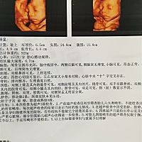 四维顺利通过，宝宝很配合。一点都不像我。这脸型跟他爹完全一样的