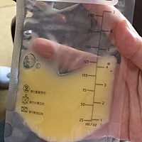 39+2抛宫产，男孩，乳名麦兜，出生3天我这个当妈的一眼没看见，因为贫血直接转院了，今天打电话在撤掉呼...