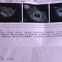 几个意思？双胞胎吗？