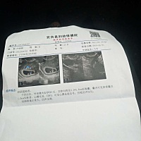 二胎，大家觉得孕囊看男女准吗，我怎么感觉我这个还是男孩呀，好纠结，男宝宝爸就不让要了，好难过，还...