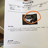 大家帮忙看下，这是不是有双胞胎的嫌疑？？？