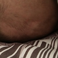 有没有一样的孩子，医生说是白癜风，我不相信老天爷给我们开真大的玩笑