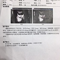 【难怪我没有孕吐，原来这三类容易孕吐的类型，我一个也没有中 - 今日头条】https://m.toutiaocdn.com/i...