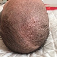 请问 宝宝头上长的这些小包是什么