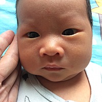 哪位宝妈知道宝宝脸上这是什么？  出生的时候白白净净  现在脸上长这些  看着都心痛  求告知！！！