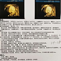 宝宝不配合，爬了十几次楼梯四维彩超才过，谁能看出是小乔治，还是小佩齐☺