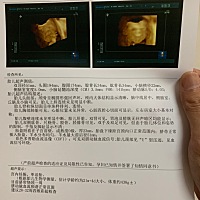 求乔治还是佩奇，科普下。