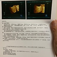 有人看出乔治还是佩奇吗？科普下，感谢