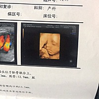 倒计时32天预产期，四维宝宝像男孩还是女孩呢，又期待又紧张