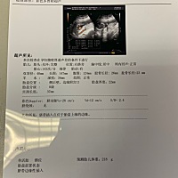 孕期18周，医生说孩子大小比标准值小一周，小腿短，多补钙。另一个是要少运动多休息，保持心情舒畅，见...