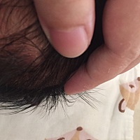 宝宝头皮上都是白色小米粒、前些日子穿两件热得脸上起湿疹后就只穿了一件、穿一件衣服有三天了、也盖不...