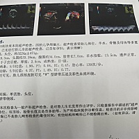 各位亲看看是乔治还是佩奇