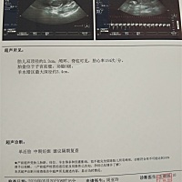 谁会看男女
