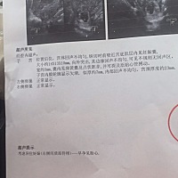 有没有宝妈和我的情况一样，平平安安的生下宝宝的，我不想打掉！医生让我打我舍不得