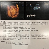 四维通过～好丑～ 希望如愿🙏