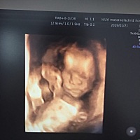 心心念念的女儿如愿了，儿女双全5月12日剖，5.12斤，图五，图六是哥哥，哥哥今年10岁了