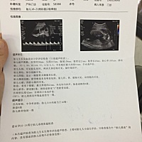 求有经验的宝妈看看是男宝还是女宝，每天都很好奇，或者推荐鉴别的方法