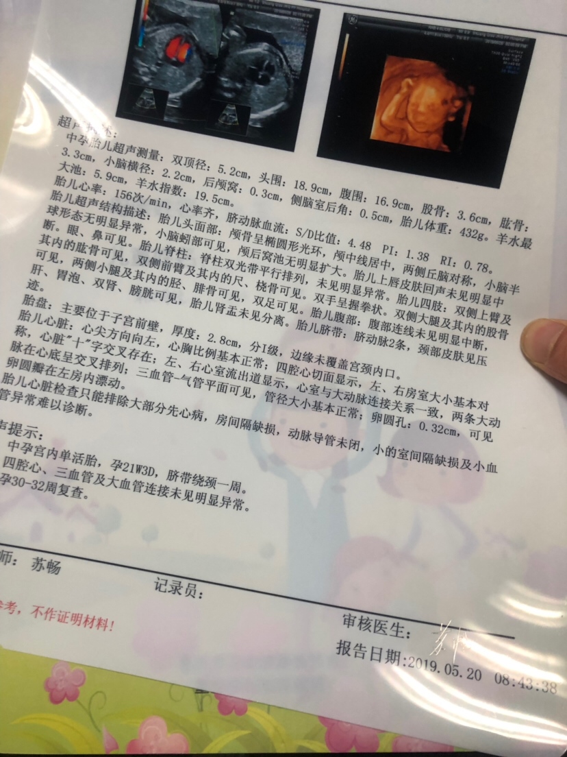 问医生是儿子女儿她告诉我是个娃儿😅