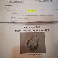 为拼三胎宝宝，在婆婆压力下极其不情愿去泰国试管，幸好一次成功！ 经过跟医院详细了解之后，最后确定了...