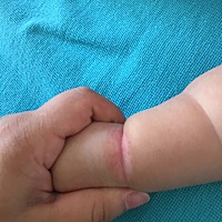 宝妈们你们知道这是什么吗？好像不像是捂的宝宝有时候会舔这里