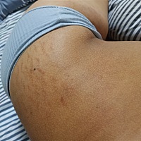 谁有我黑？？？这是二胎，怀个孕黑成这样