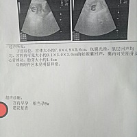 怀孕八周照的，你们有会看男女的吗？谢谢来围观。