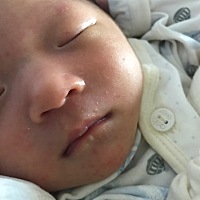 天气热宝宝下巴位置长了好多小红点，该怎么办啊