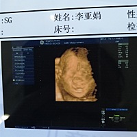 也不知道男宝还是女宝，大家看看像爸爸还是妈妈