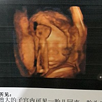 四维丑成这样、我都要哭了。求男宝吖～ 女孩子一定要美美得～