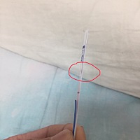 这是什么情况在线等 但是怎么第二杠地方不对呢。大姨妈延迟两天心里难受想吐头几天乳头碰到就疼痛，是不...