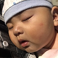 宝宝一直拉肚子，刚吃完过一会就拉了，奶粉喂养，去医院检查没有肠炎也没有乳糖不耐受也没有蛋白质过敏...